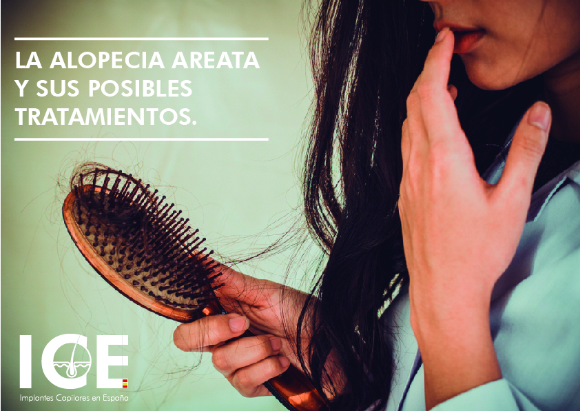 LA ALOPECIA AREATA Y SUS POSIBLES TRATAMIENTOS.